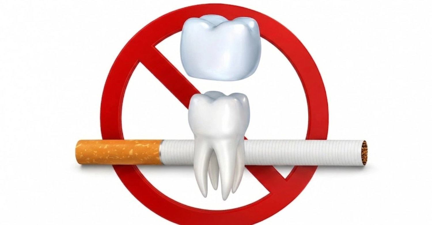 Can You Smoke After a Dental Crown